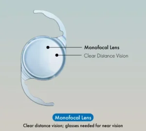 Monofocal For Distance Vision
