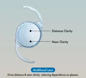 Multifocal for both Far and Near Vision
