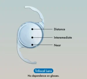 Trifocal lenses