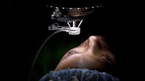 LASIK eye surgery being performed with laser correction on patient’s cornea at Vision Care Eye Clinic Bahawalpur